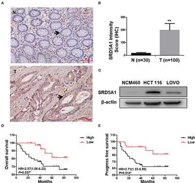 Steroid 5α-Reductase Type I Induces Cell Viability and Migration via Nuclear Factor-κB/Vascular Endothelial Growth Factor Signaling Pathway in Colorectal Cancer